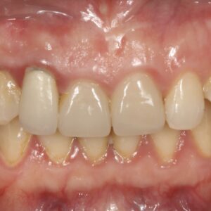 40before