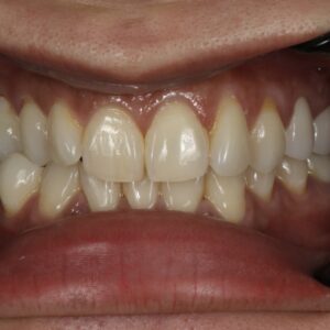 50before