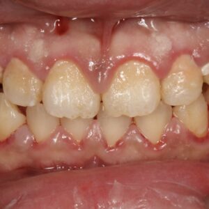 60before