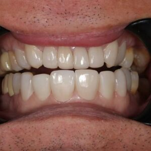 72after
