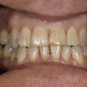 72before