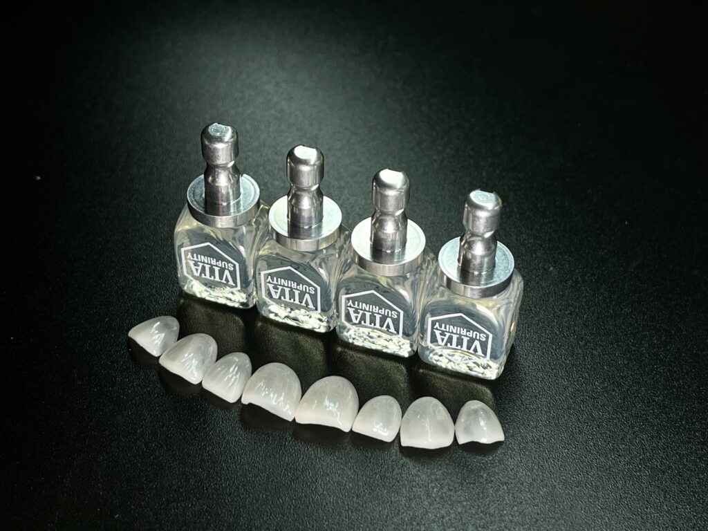 牙貼面