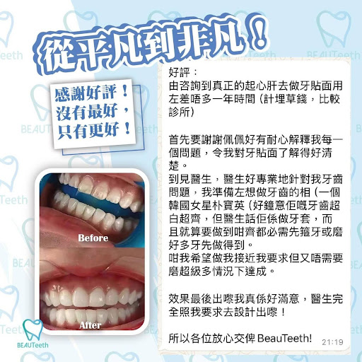 牙科治療好評3